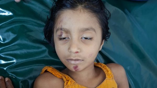 পূর্বধলায় অটোরিকশা নীচে চাপা পড়ে মাদ্রাসা শিক্ষার্থী নিহত